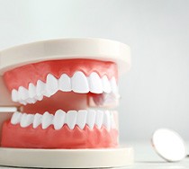 Dental mirror lying next to model of teeth